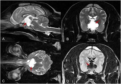 A Recurrent Suprapituitary Ependymal Cyst Managed by Endoscopy-Assisted Transsphenoidal Surgery in a Canine: A Case Report